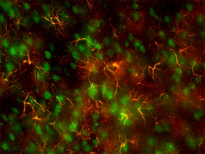 Schnittpr?parat eines Rattenhirns mit Nervenzellen (grn) und Gliazellen (rot).